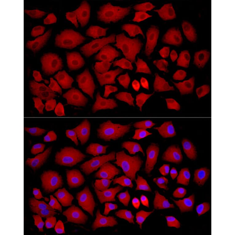 Immunofluorescence - Anti-SLC27A2 Antibody (A13054) - Antibodies.com