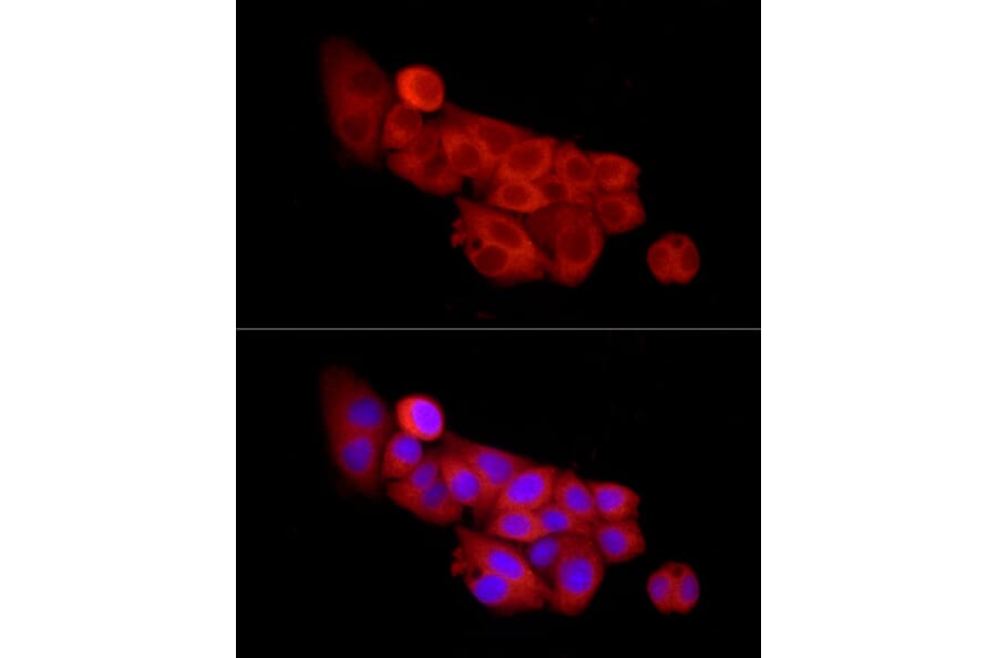 Immunofluorescence - Anti-SLC27A2 Antibody (A13054) - Antibodies.com