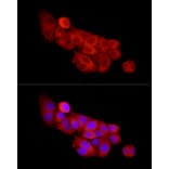Immunofluorescence - Anti-SLC27A2 Antibody (A13054) - Antibodies.com
