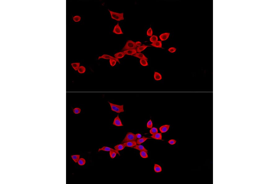 Immunofluorescence - Anti-SLC27A2 Antibody (A13054) - Antibodies.com
