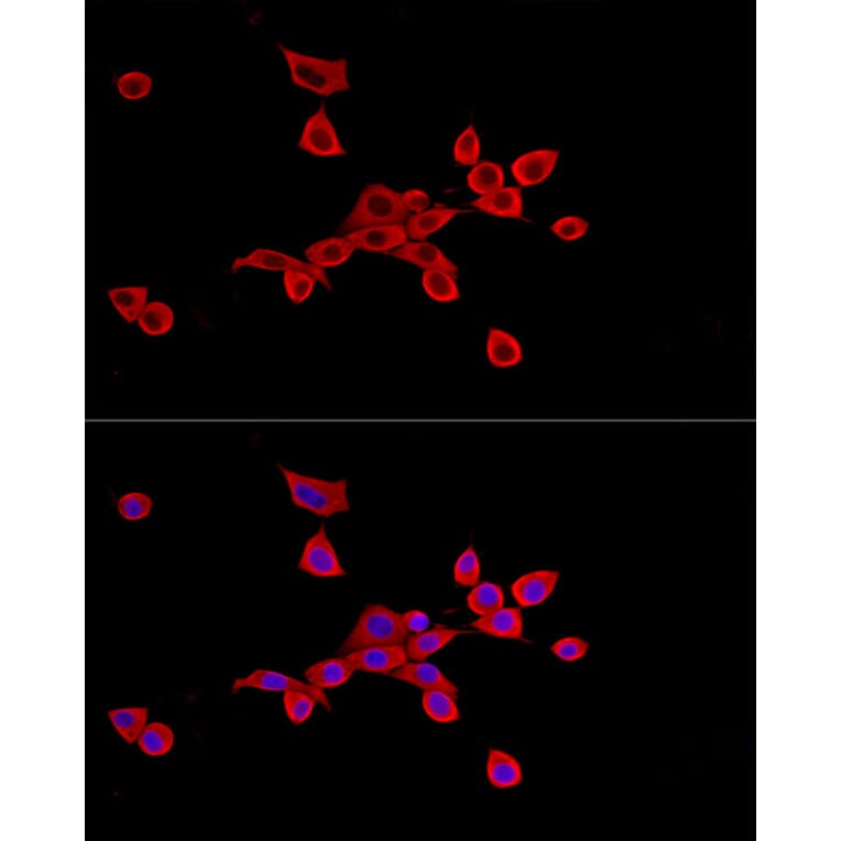 Immunofluorescence - Anti-SLC27A2 Antibody (A13054) - Antibodies.com