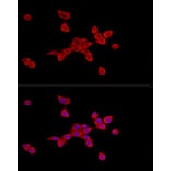 Immunofluorescence - Anti-SLC27A2 Antibody (A13054) - Antibodies.com