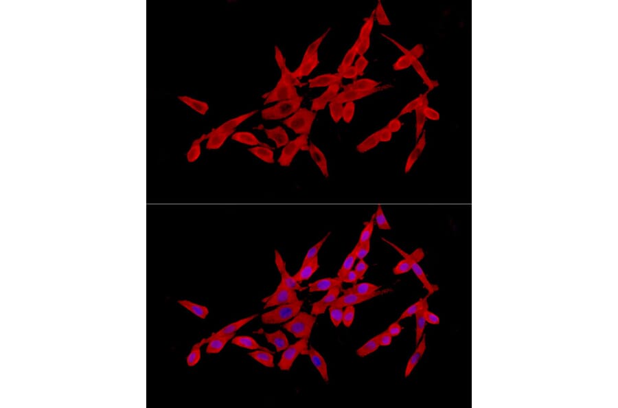 Immunofluorescence - Anti-SLC27A2 Antibody (A13054) - Antibodies.com