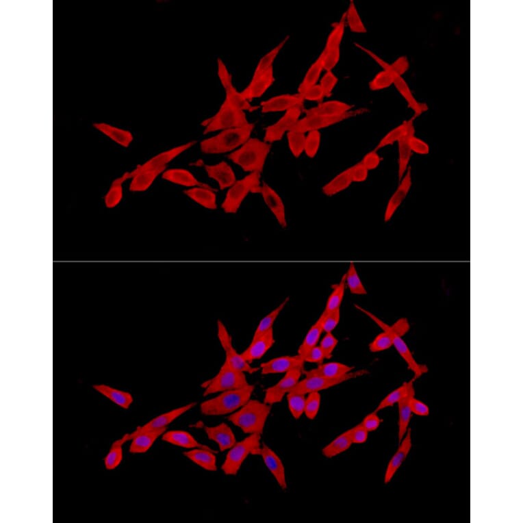 Immunofluorescence - Anti-SLC27A2 Antibody (A13054) - Antibodies.com