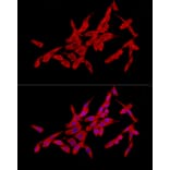 Immunofluorescence - Anti-SLC27A2 Antibody (A13054) - Antibodies.com