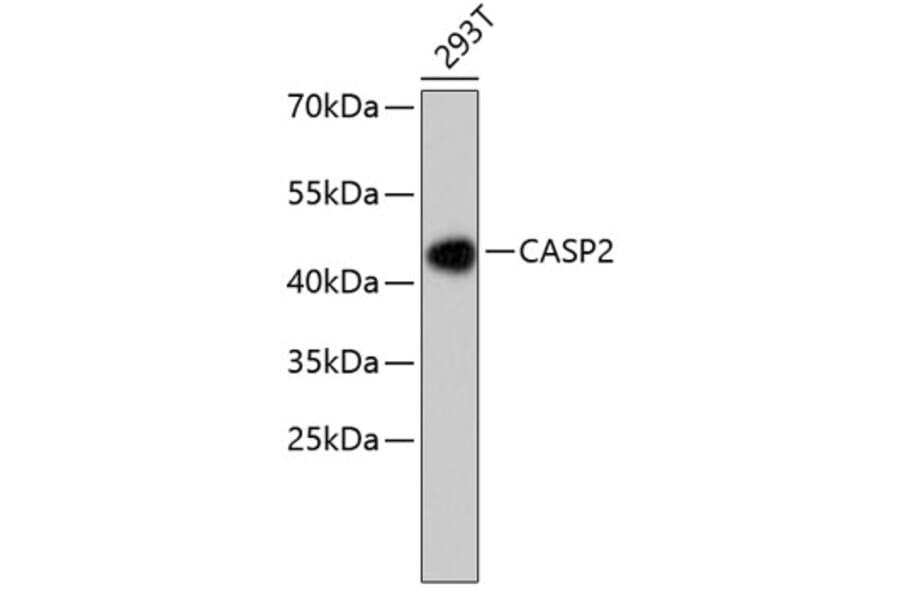 Western Blot - Anti-CASP2 Antibody (A10772) - Antibodies.com