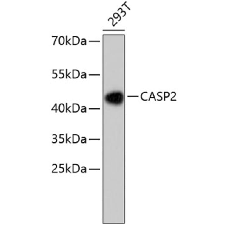Western Blot - Anti-CASP2 Antibody (A10772) - Antibodies.com