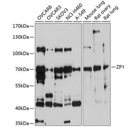 Western Blot - Anti-ZP1 Antibody (A13059) - Antibodies.com