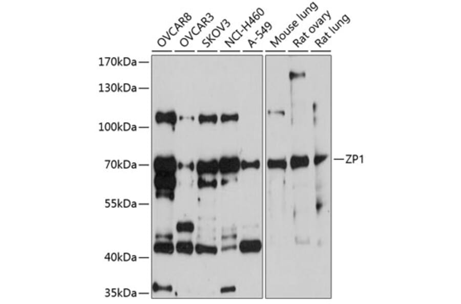 Western Blot - Anti-ZP1 Antibody (A13059) - Antibodies.com
