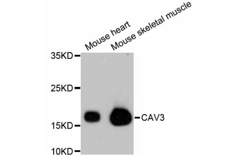 Western Blot - Anti-CAV3 Antibody (A10781) - Antibodies.com
