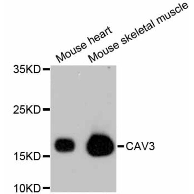 Western Blot - Anti-CAV3 Antibody (A10781) - Antibodies.com