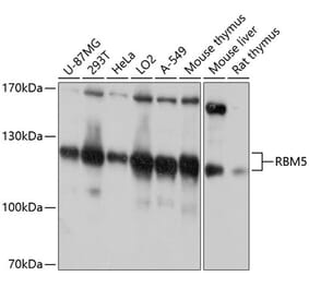 Western Blot - Anti-RBM5 Antibody (A13064) - Antibodies.com