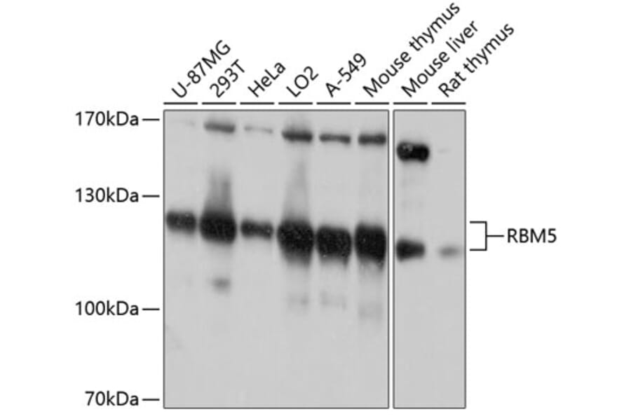 Western Blot - Anti-RBM5 Antibody (A13064) - Antibodies.com