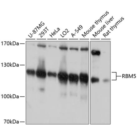 Western Blot - Anti-RBM5 Antibody (A13064) - Antibodies.com