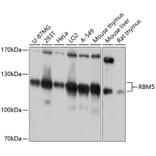 Western Blot - Anti-RBM5 Antibody (A13064) - Antibodies.com
