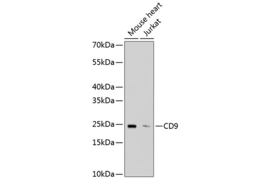 Western Blot - Anti-CD9 Antibody (A10789) - Antibodies.com