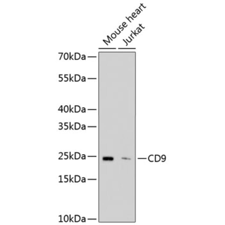 Western Blot - Anti-CD9 Antibody (A10789) - Antibodies.com