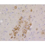 Immunohistochemistry - Anti-CD9 Antibody (A10789) - Antibodies.com
