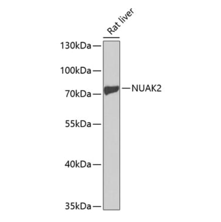 Western Blot - Anti-NUAK2 Antibody (A13066) - Antibodies.com