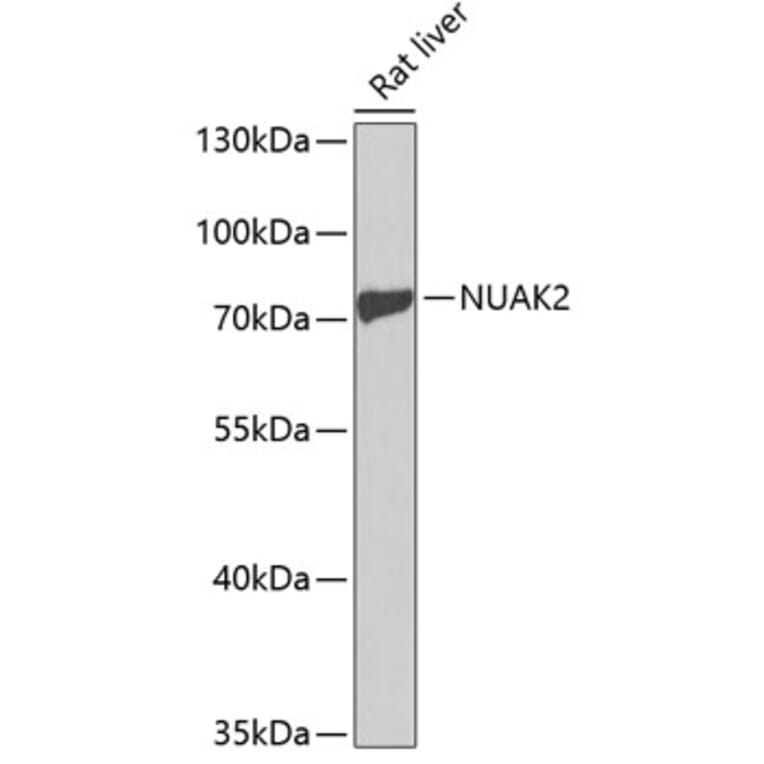 Western Blot - Anti-NUAK2 Antibody (A13066) - Antibodies.com