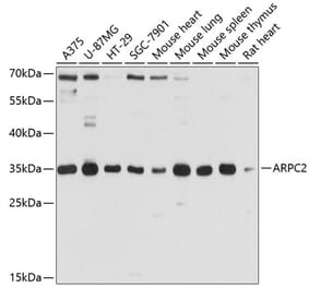 Western Blot - Anti-ARPC2 Antibody (A13067) - Antibodies.com