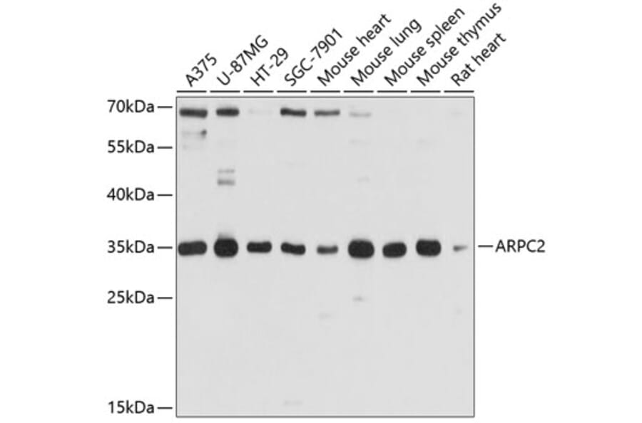 Western Blot - Anti-ARPC2 Antibody (A13067) - Antibodies.com