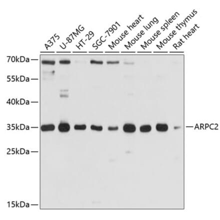 Western Blot - Anti-ARPC2 Antibody (A13067) - Antibodies.com