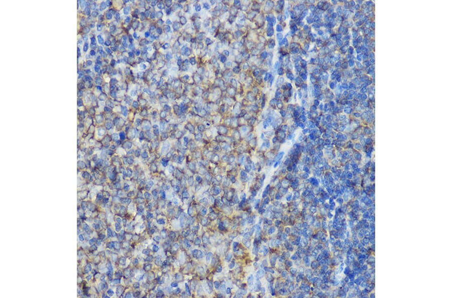 Immunohistochemistry - Anti-ARPC2 Antibody (A13067) - Antibodies.com