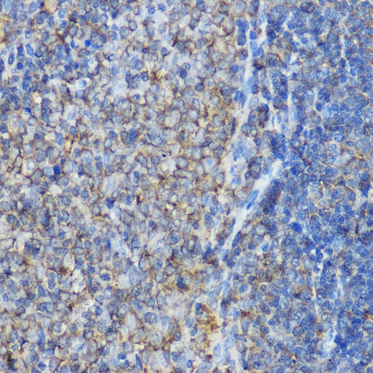 Immunohistochemistry - Anti-ARPC2 Antibody (A13067) - Antibodies.com