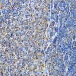 Immunohistochemistry - Anti-ARPC2 Antibody (A13067) - Antibodies.com