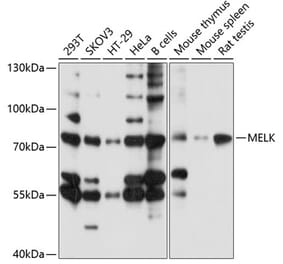 Western Blot - Anti-MELK Antibody (A13068) - Antibodies.com