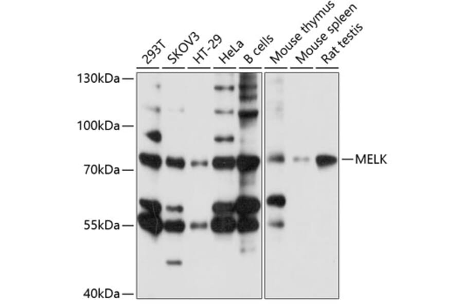 Western Blot - Anti-MELK Antibody (A13068) - Antibodies.com