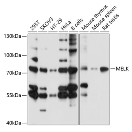 Western Blot - Anti-MELK Antibody (A13068) - Antibodies.com