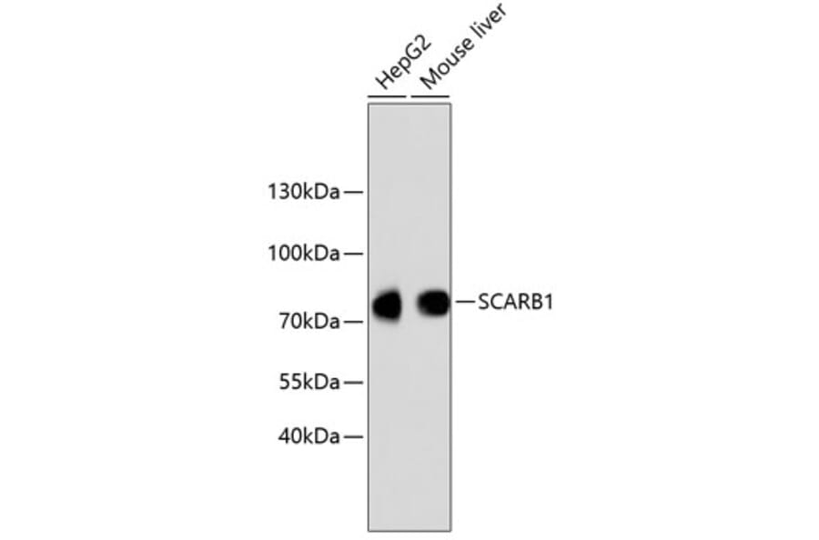 Western Blot - Anti-SCARB1 Antibody (A10799) - Antibodies.com