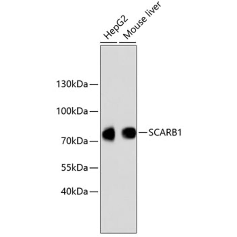 Western Blot - Anti-SCARB1 Antibody (A10799) - Antibodies.com