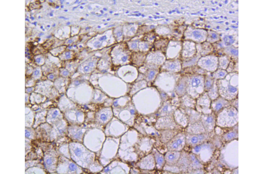 Immunohistochemistry - Anti-SCARB1 Antibody (A10799) - Antibodies.com