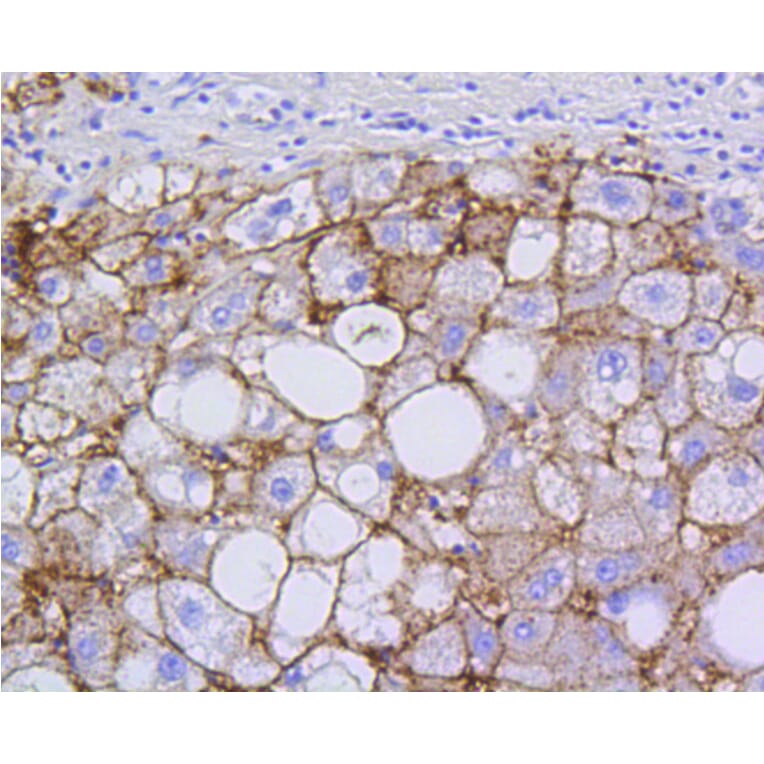 Immunohistochemistry - Anti-SCARB1 Antibody (A10799) - Antibodies.com