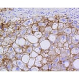 Immunohistochemistry - Anti-SCARB1 Antibody (A10799) - Antibodies.com