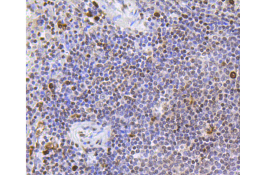 Immunohistochemistry - Anti-SCARB1 Antibody (A10799) - Antibodies.com