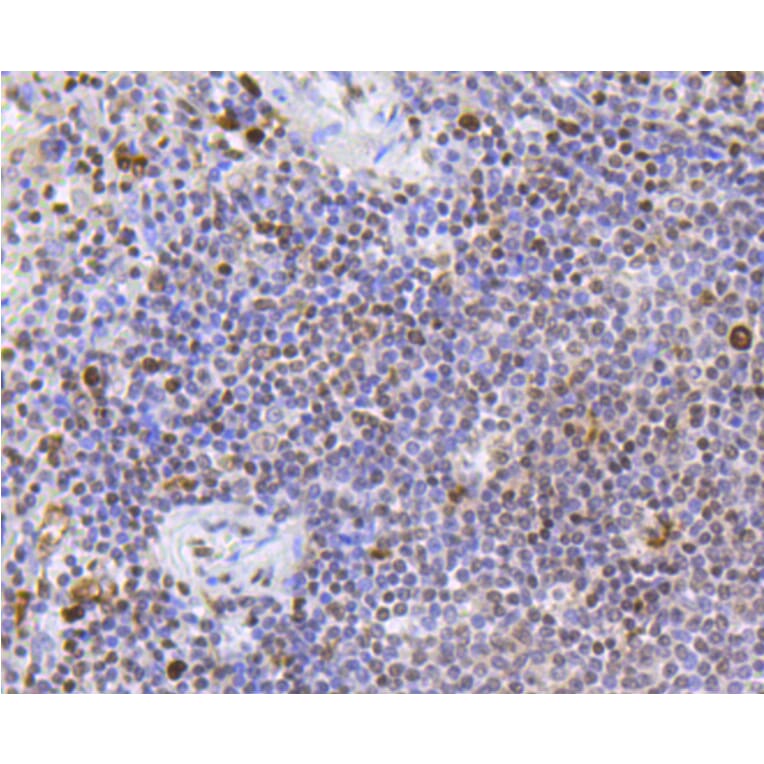 Immunohistochemistry - Anti-SCARB1 Antibody (A10799) - Antibodies.com