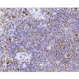 Immunohistochemistry - Anti-SCARB1 Antibody (A10799) - Antibodies.com
