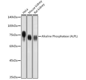 Western Blot - Anti-Alkaline Phosphatase, Tissue Non-Specific Antibody (A13070) - Antibodies.com