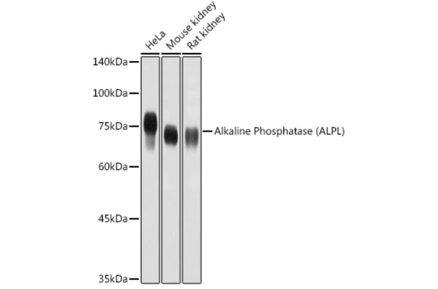 Western Blot - Anti-Alkaline Phosphatase, Tissue Non-Specific Antibody (A13070) - Antibodies.com