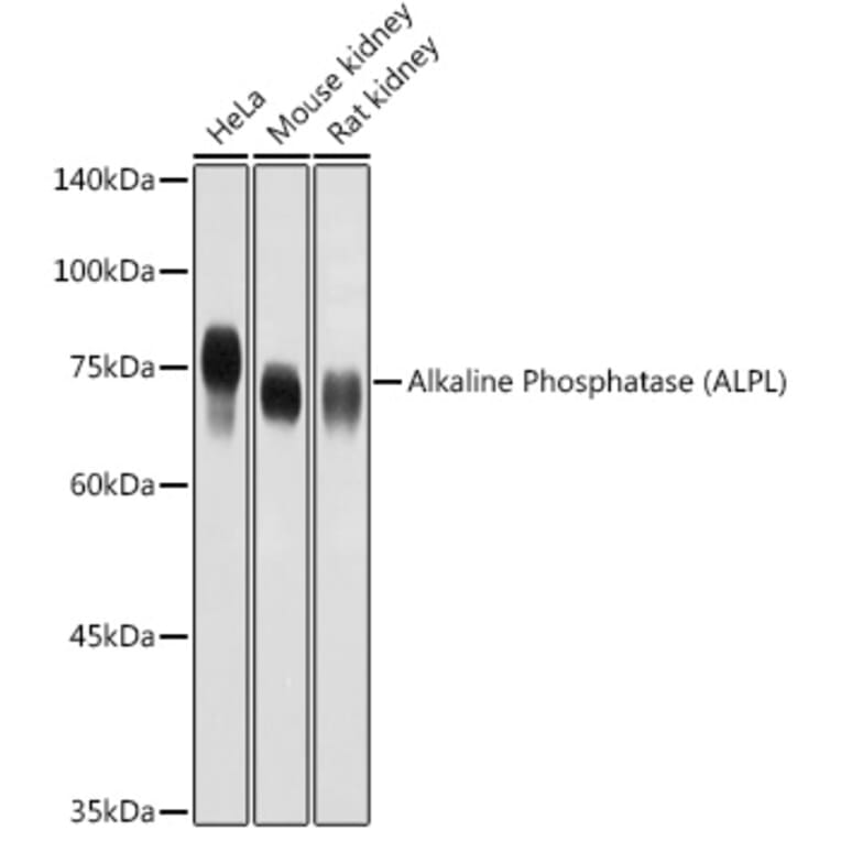 Western Blot - Anti-Alkaline Phosphatase, Tissue Non-Specific Antibody (A13070) - Antibodies.com