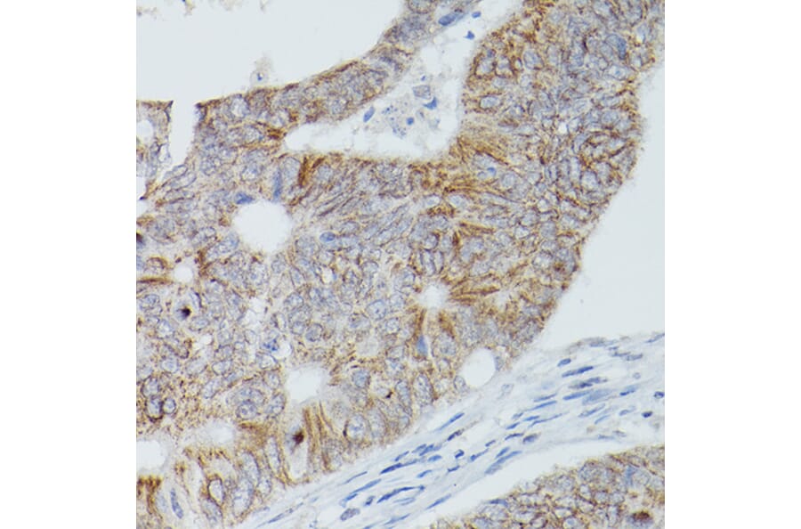 Immunohistochemistry - Anti-Alkaline Phosphatase, Tissue Non-Specific Antibody (A13070) - Antibodies.com