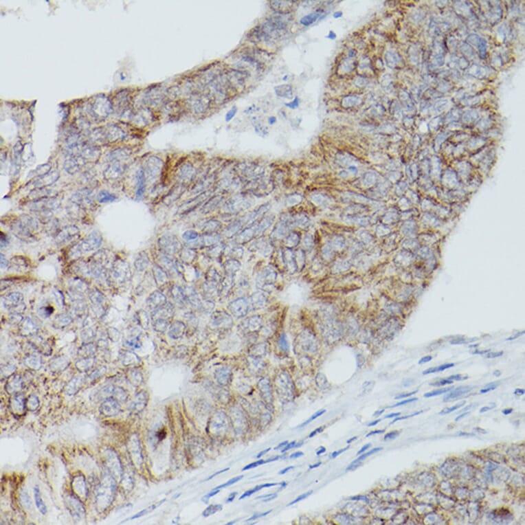 Immunohistochemistry - Anti-Alkaline Phosphatase, Tissue Non-Specific Antibody (A13070) - Antibodies.com