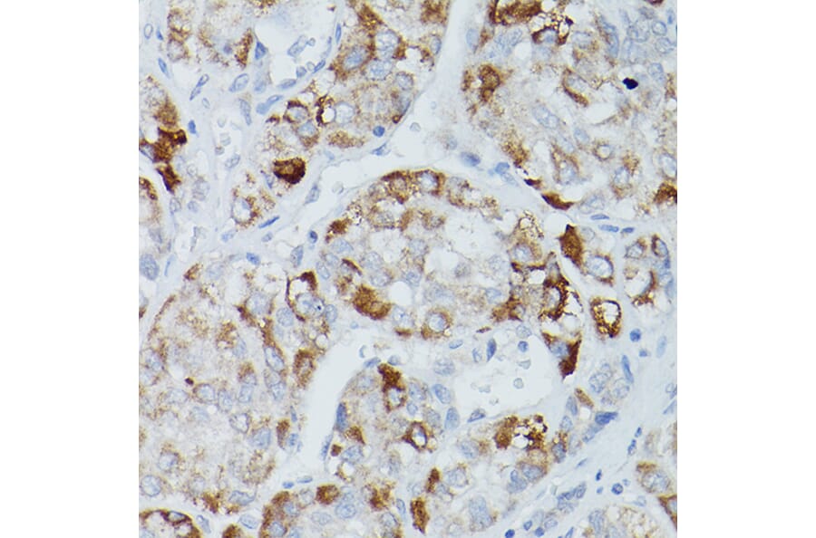 Immunohistochemistry - Anti-Alkaline Phosphatase, Tissue Non-Specific Antibody (A13070) - Antibodies.com
