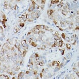 Immunohistochemistry - Anti-Alkaline Phosphatase, Tissue Non-Specific Antibody (A13070) - Antibodies.com