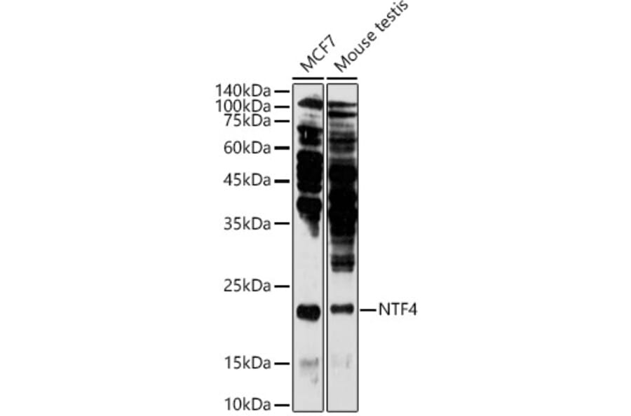 Western Blot - Anti-NT-4 Antibody (A13073) - Antibodies.com