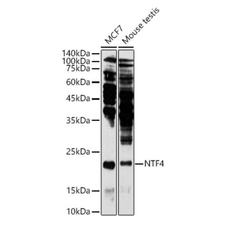 Western Blot - Anti-NT-4 Antibody (A13073) - Antibodies.com